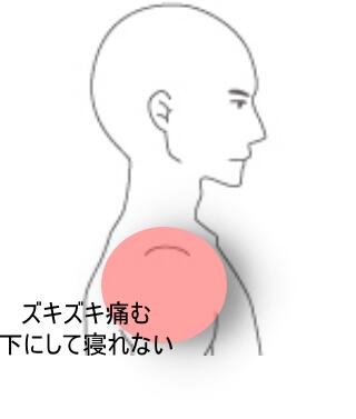 五十肩