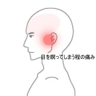 顎関節症