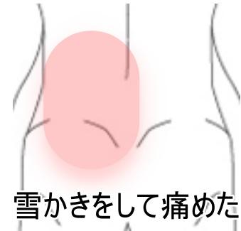 腰痛