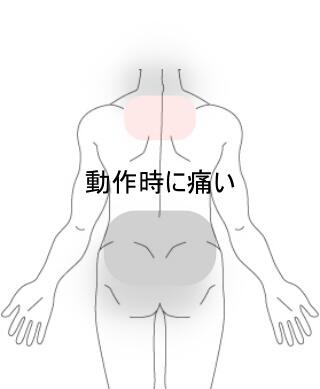 腰臀部痛