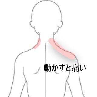 首の痛み