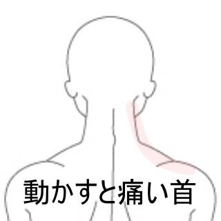 頸部痛