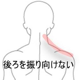 寝違え