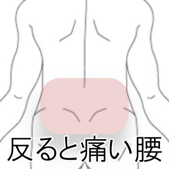 反ると痛い腰