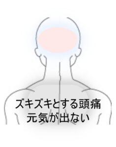 頭痛