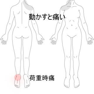踵首の痛み