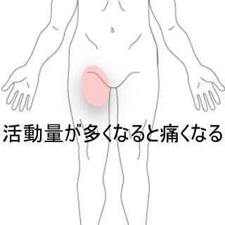 股関節の痛み
