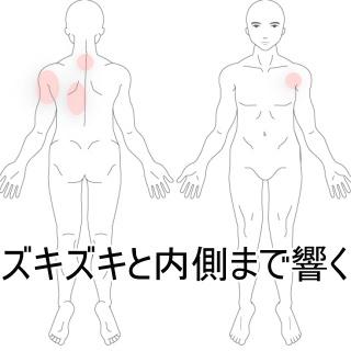 ズキズキと響く首の痛み