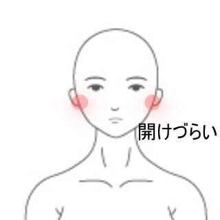 顎の痛み