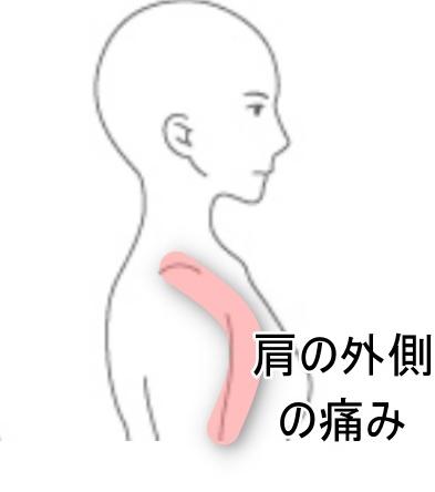 肩の外側の痛