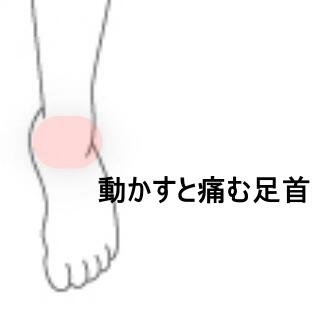 足首の痛み