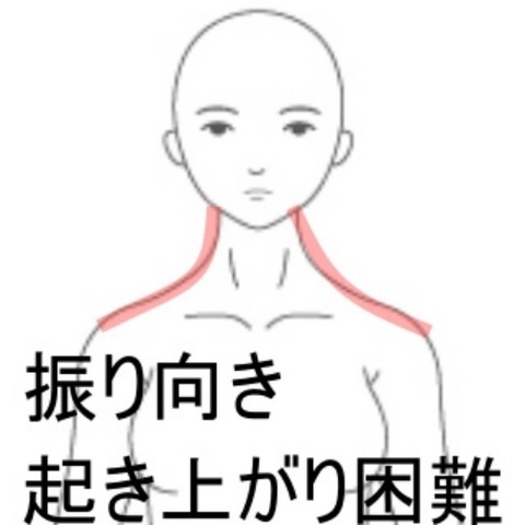 寝違え