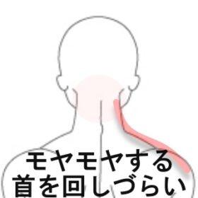 頭痛