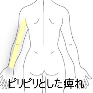腕の痺れ