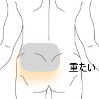腰痛