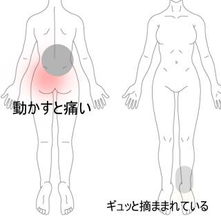 腰痛
