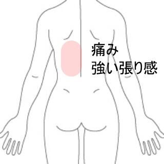 背部痛