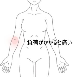 肘腕