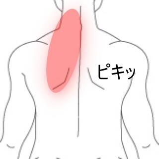 背部痛 1
