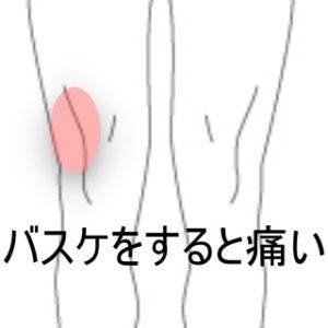 膝の痛み