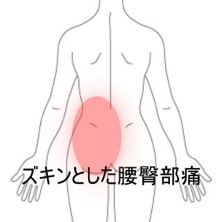 腰臀部痛