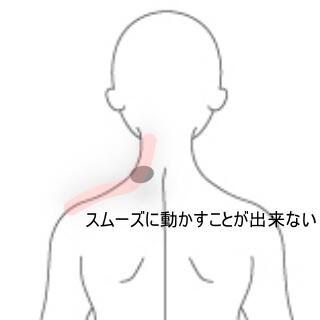 首のコリ