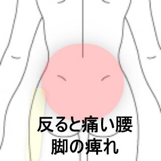 腰痛臀部痛