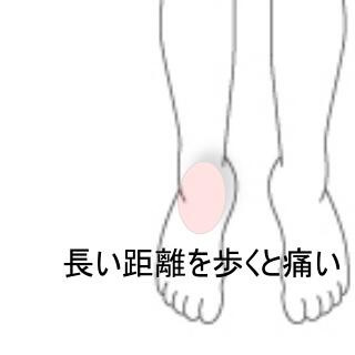 足首痛