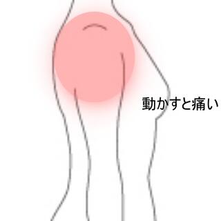 肩の痛み