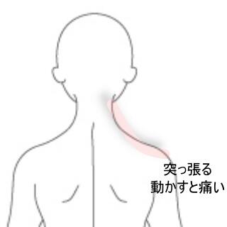 首肩の痛み