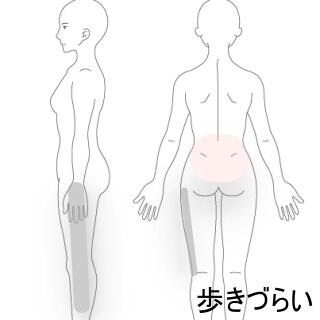 大腿部痛