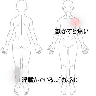 足の痛み