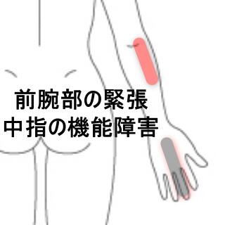腕