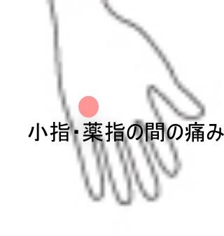 手の痛み