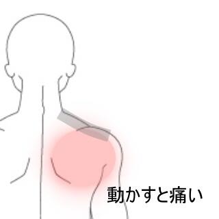 肩の痛み