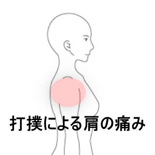 肩の痛み