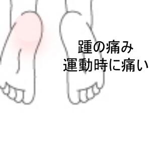踵の痛み