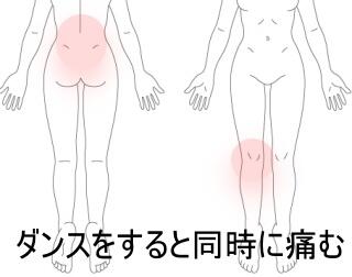 膝の痛み