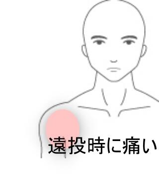 野球肩