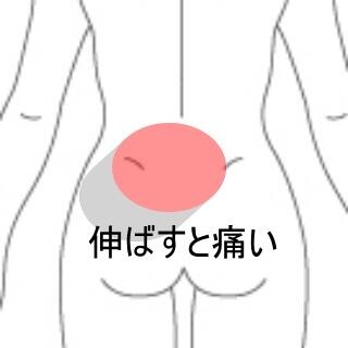 腰痛