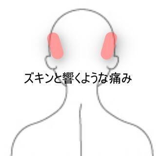 頭痛