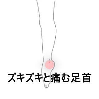 足首