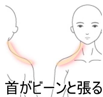 首の張り感