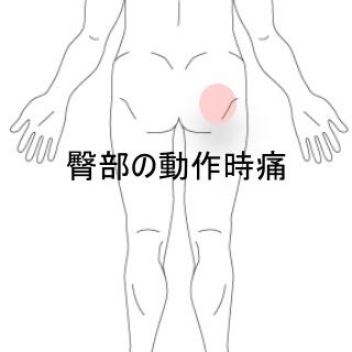臀部
