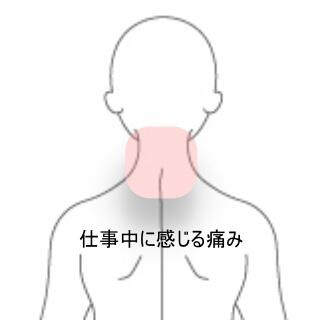 頸部痛