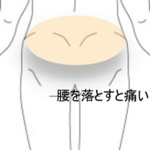 腰痛