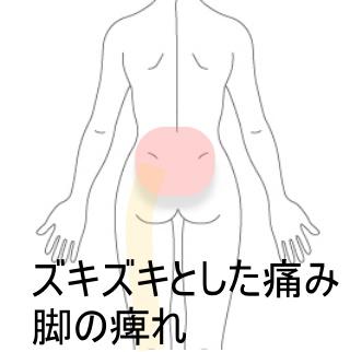 脚の痺れと腰の痛み