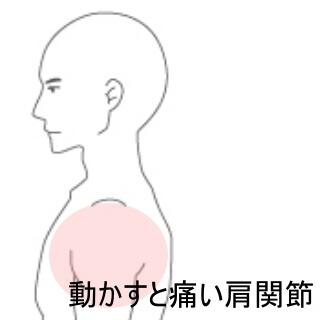 肩の痛み