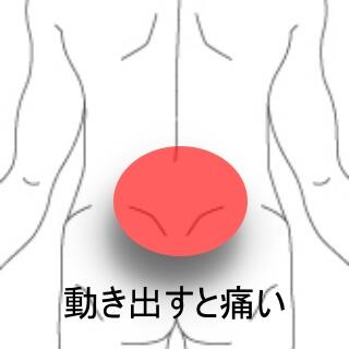 腰痛