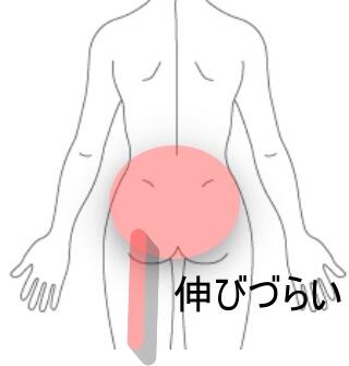 腰痛